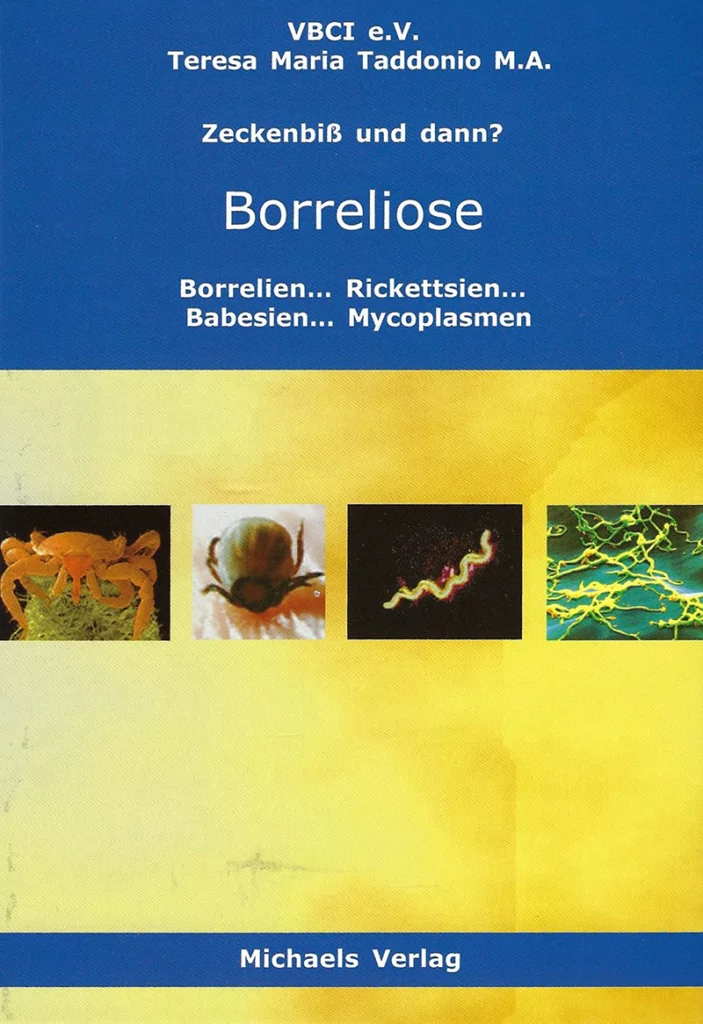 borreliose-703x1024