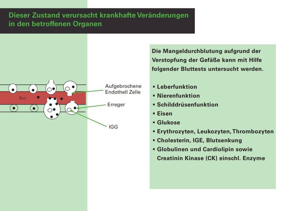 Dieser Zustand verursacht krankhafte Veränderungen